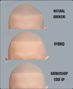 Understanding Hairlines in Scalp Micropigmentation: Natural, Hybrid, and Barbershop Edge-Up