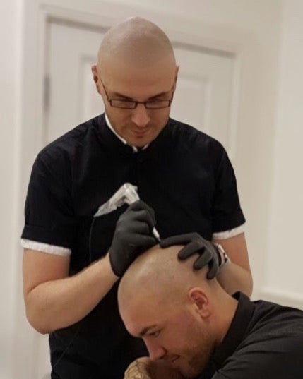 The Expertise of Marcin Adam in Scalp Micropigmentation